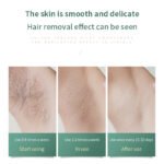 Women Painless Laser Epilator Permanent Hair Removal Device - Image 6