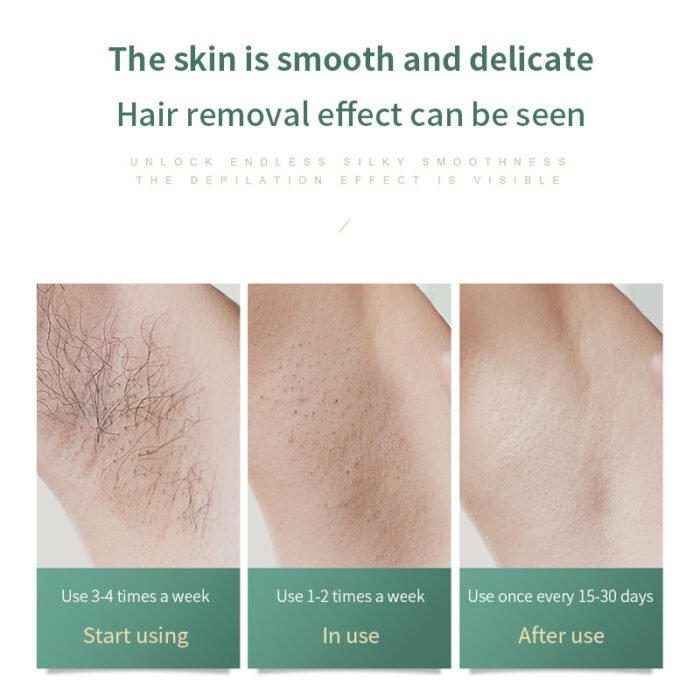 1612853906145.jpg Women Painless Laser Epilator Permanent Hair Removal Device - Image 6